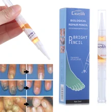 Жидкая ручка для лечения грибковых ногтей, яркие ногти, ремонт пальцев и пальцев ног, онихомикоз, эссенция для удаления ухода за ногами