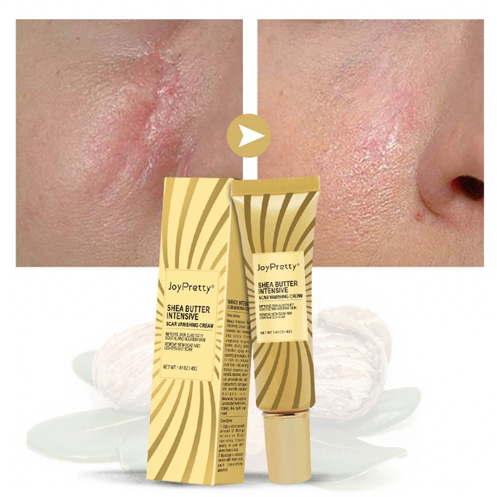 1 PCS Acne Scar Removal Cream Pimples Stretch Marks Face Gel Remove Smoothing Whitening Moisturizing Body Skin Care | Красота и