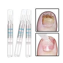 3 мл жидкость для лечения Ногтей, анти-фунгустриатмент, ручка, тщательный уход за пальцами, пальцами, ногтями, восстановление, обычный ноготь, глянцевая форма, TSLM1