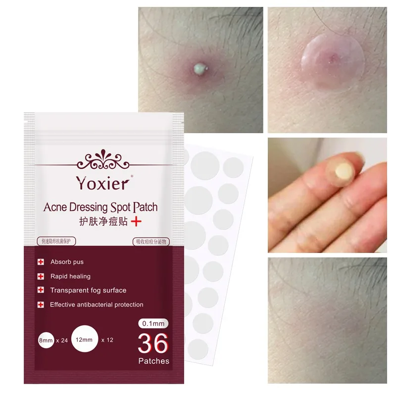 36pcs акне Spogliatoio Cerotto Posto Cura Della Пелле Macchia Trattamento модные удобные осенние женские ботильоны акне Adesivi инструмент для удаления прыщей набор инструментов