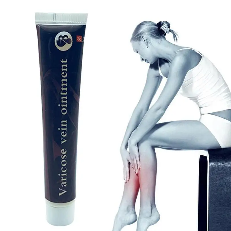

20g Varicose Veins Miracle Cream Treatment Effective Cure Vasculitis Phlebitis Spider Veins Pain Relief Herbal Angiitis Ointment