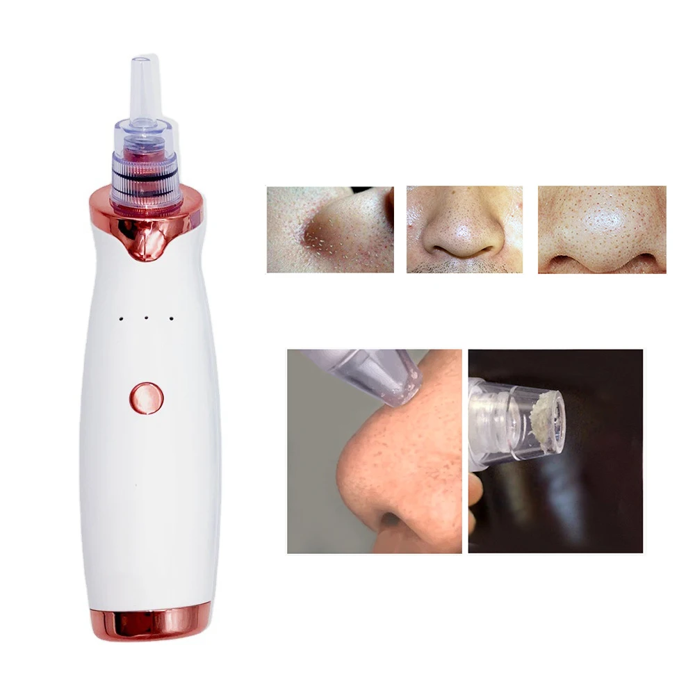 Прибор для удаления черных точек на лице электрический пылесос аппарат очищения