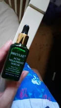Serum Face-Mask Skin-Care Acne-Treatment BREYLEE Cosmetics Face-Essence-Removal-Spots