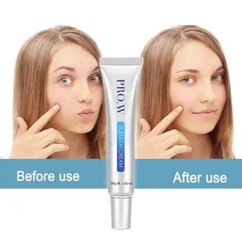 

1Pcs Liquid Make Up Concealer Color Corrector Foundation Cover Cream Acne Makeup Scars Contouring Waterproof I2U3