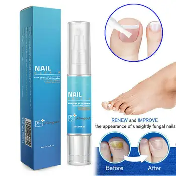 

1Pcs Anti Fungal Nail Treatment Finger Toe Care Nail Fungus Treatment Liquid Pen Repair Antifungal Nutritious Oil