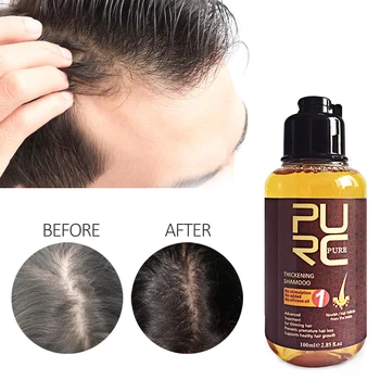 

Original Ginger Shampoo Anti Hair Fall Soothe Itchy Irritated Scalp Thick Hair Make Shiny and Soft Hair Care