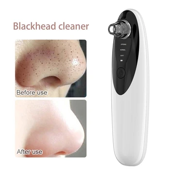 

Blackhead Remover with Camema Visible Electric Blackhead Suction Device 300,000 Pixels 64 kPa Suctioner with 4 Probes