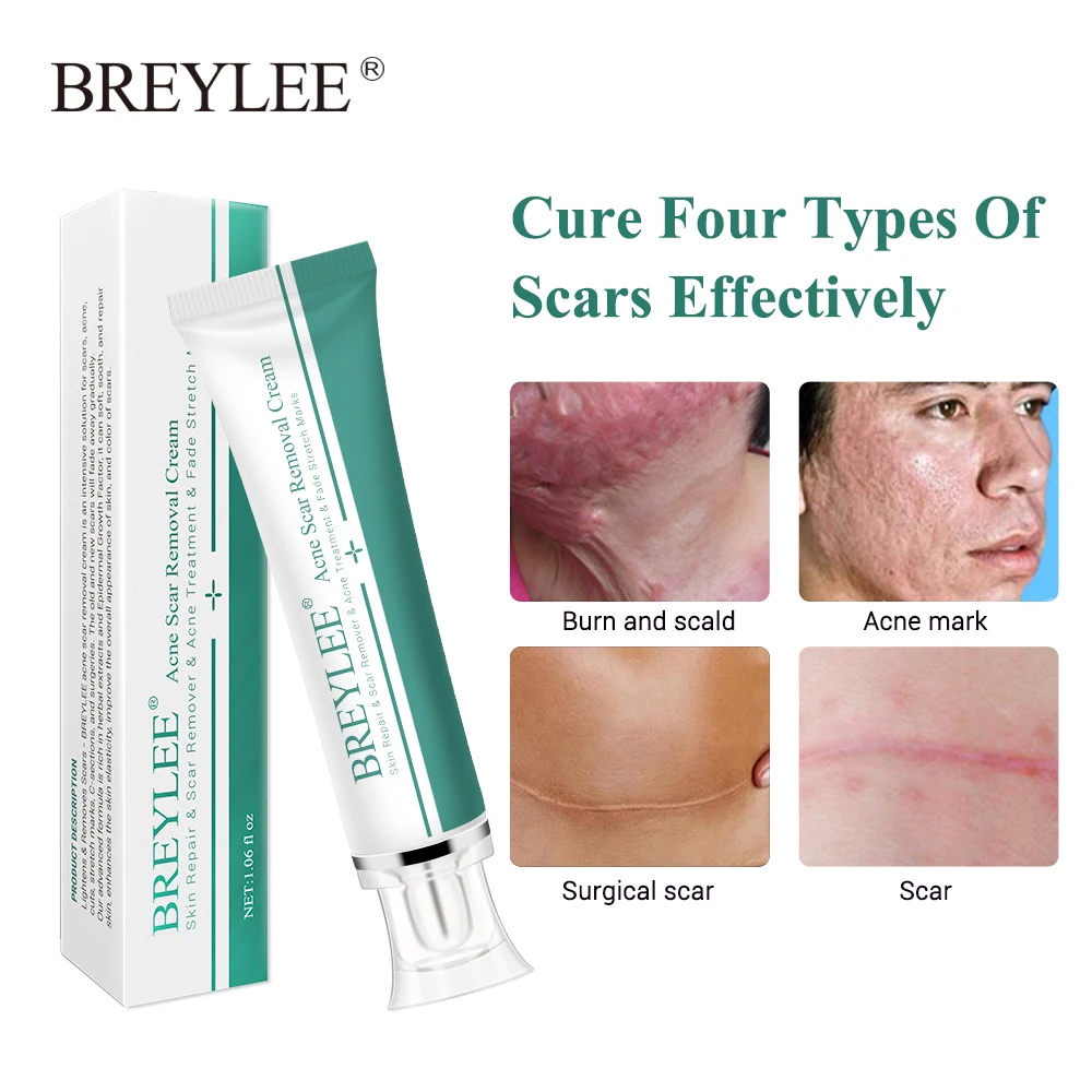 BREYLEE Acne Scar Removal Cream 30g Face Cream Skin Repair Skin Care Scar Acne Treatment Remove Stretch Marks Whitening Cream   (2)