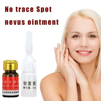 

3ml Professional Painless Mole Removal Cream Cream Nail Removal Nail Cream Cream Treatment F2V8