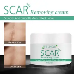 Acne Scar Removal Cream Repair Acne Spots Acne Treatment Blackhead Whitening Shrink Pores Stretch Marks Skin Care 30ml