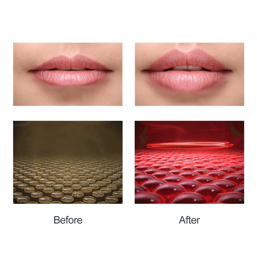 LESCOLTON Lip Plumper Rechargeable LED Devices Silicone Lip Plumper Tool LED Light Therapy Lip Enhancer Lip Care Tools Home Use