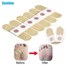12/24/30/42 pcs Foot Corn Removal Warts Thorn Pain Relieving Patch Medical Plasters Calluses Patch Foot Care Tools Toe Protector