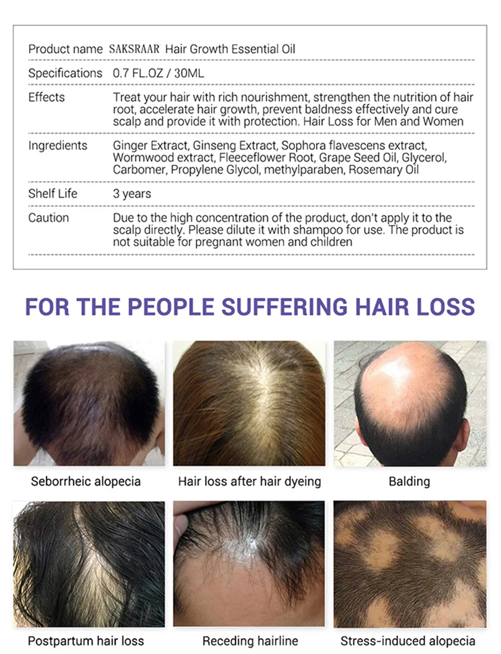 Hair Growth Essential Oils Hair Care Essence Original Authentic 100 Hair Loss Liquid Health Care Beauty Dense Hair Growth Serum Hair Loss Products Aliexpress Hair Growth Essential Oils Hair Care Essence Original Authentic 100 Hair Loss Liquid Health Care Beauty Dense Hair Growth Serum Hair Loss Products Aliexpress