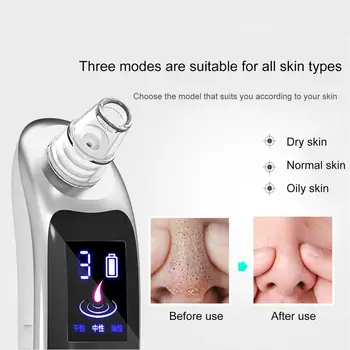 

Charging Blackhead Instrument Charging Home Beauty Cleansing Remove Blackhead Pores Clean Electric Blackhead Cleaner