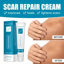 

Scar Removal Cream Repair Burn Scars Stretch Marks Face Gel Remove Body Pigmentation Corrector Smoothing Moisturizing Skin Care