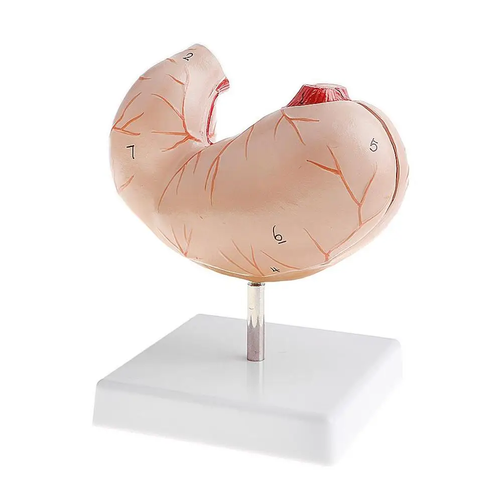 Съемная анатомическая модель с человеческим желудком 2 части 1:1 Lifesize|ulcer| |