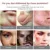 30g Acne Scar Removal Cream Прыщи Растяжки Гель Для Лица Удалить Акне Разглаживание Отбеливание Увлажняющий Уход За Кожей Тела Aichun