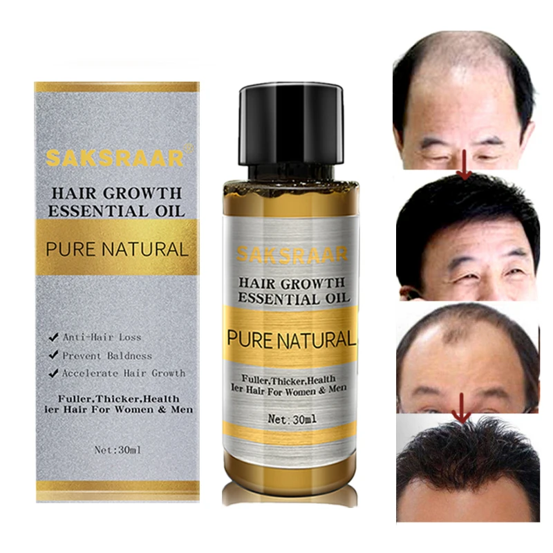 hair loss helper essential oil blend