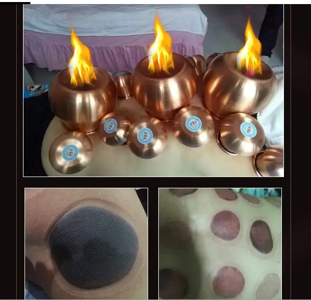 6cm*6.5cm Two Times Heating Mongolian Red Copper Fire Cupping Jars