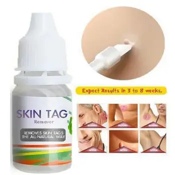

10ml Skin Tag Remover Chinese Medicine Body Warts Treatment Foot Corn Removal 12 Hours Remover Skin Tag Remover Foot Care
