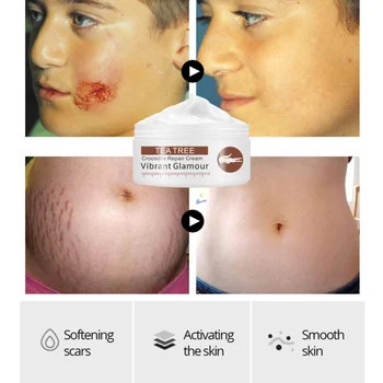 

Acne Treatment Cream Repair Face Marks Remove Acne Scar Crocodile Whitening for Stains Acne Treatment Stretch TSLM1