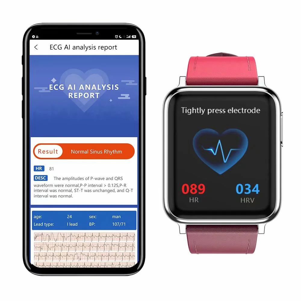 Умные часы ECG PPG для мужчин и женщин пульсометр артериальное давление кислород