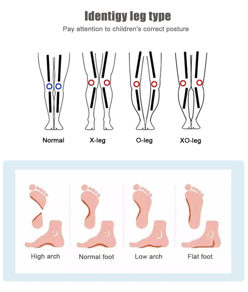 Ортопедические стельки для детей, стельки для поддержки стопы, плоскостопие, ортопедический ботинок для ног X/O