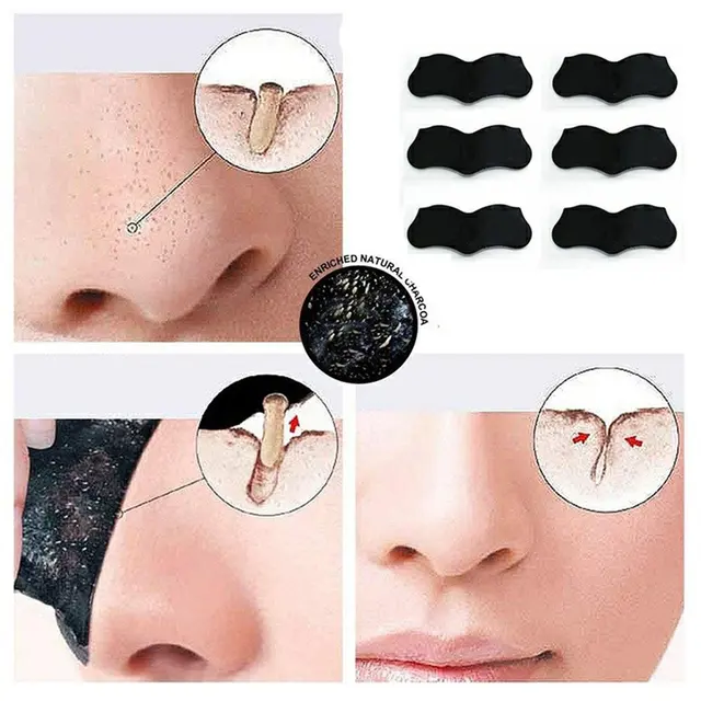 10 PCS Nose Blackhead Remover Mask Deep Cleansing Skin Care Shrink Pore Acne Treatment Mask Nose Black dots Pore Clean Strips 2