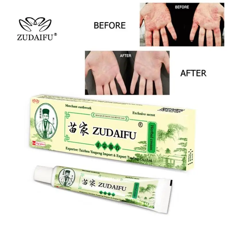ZUDAIFU кожу крем от псориаза травяной крем от псориаза Антибактериальный Dermatiti Eczematoid по уходу за кожей