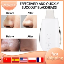 

Skin Scrubber Professional Blackhead Remover Pore Cleaner Scrubber Spatula Exfoliator 3 Modes For Deep Cleansing Skin Care Tool