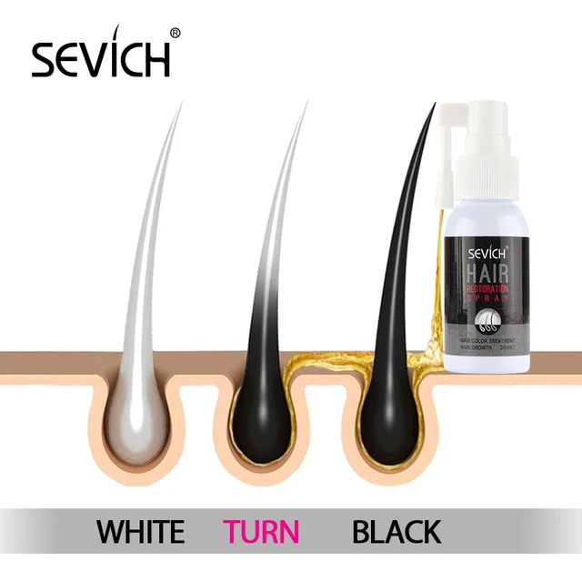 Sevich 30ml Hair Growth Spray Ginger Hair Restoration Spray Anti-Hair Loss Essence White Hair Repair Serum Hair Treatment Oil 2