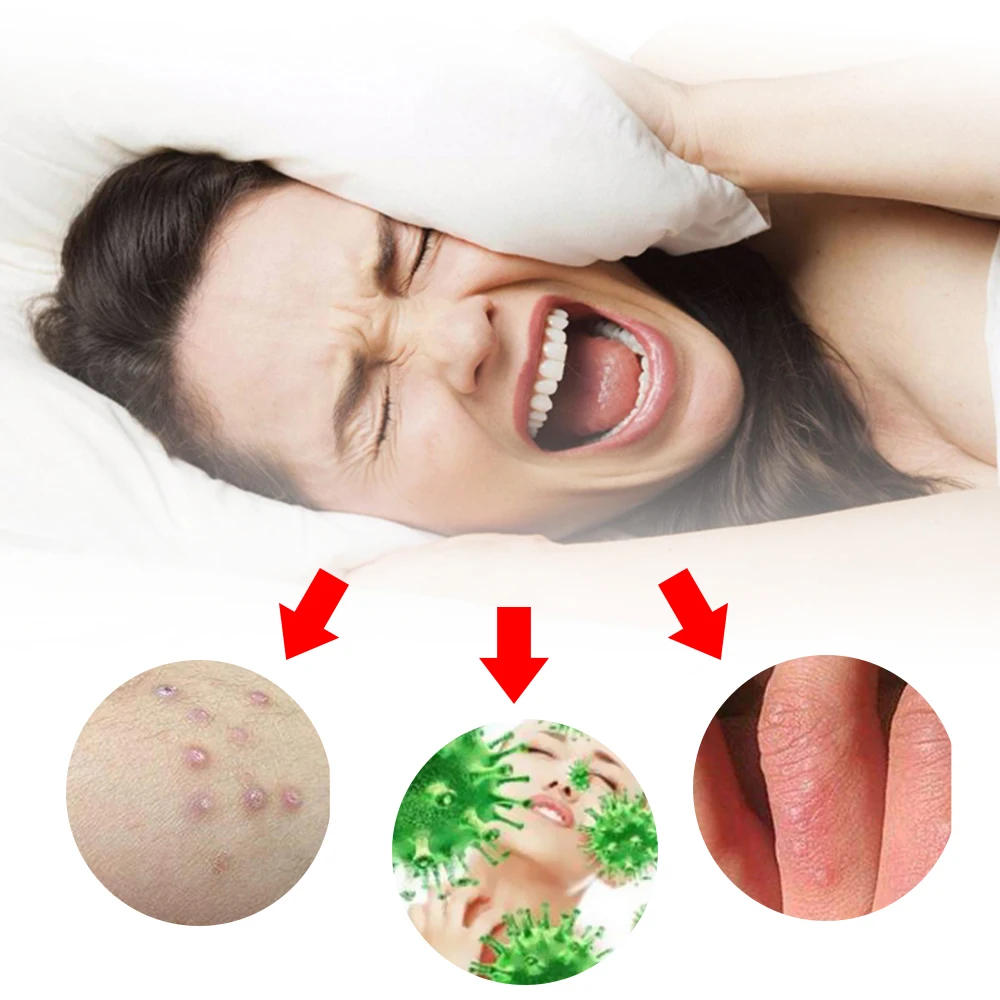 1pcs Herbal Antibacterial Cream Psoriasis Eczema Dermatitis itching Pain Relief Medical Plaster Skin Care Ointment P1097