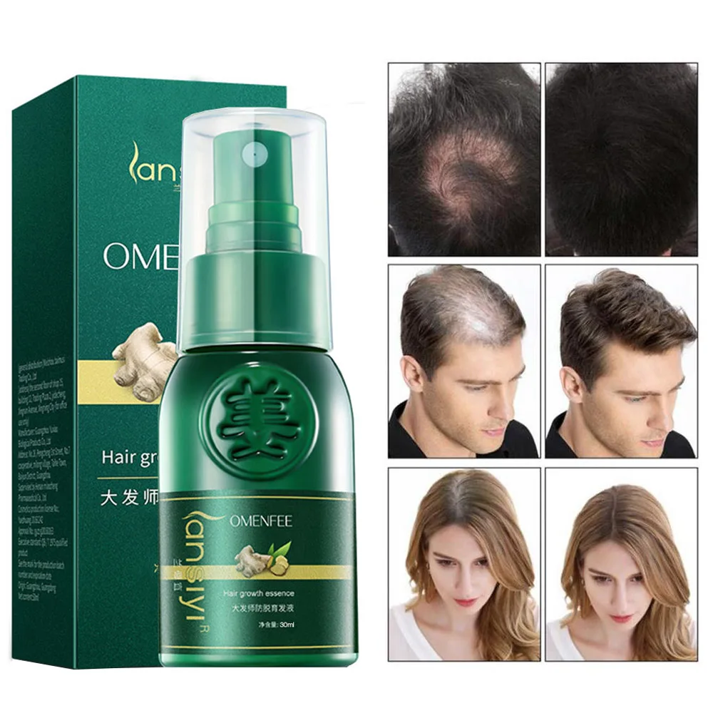 

7 Days Ginger Hair Growth Spray Serum Anti Hair Loss Products Effective Germinal Repair Growing Treatment Hair Repair Care