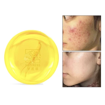 

Natural Matrine Moisturizing Cleansing Soap Effectively Removes Mites Dirt Acne whitening soap