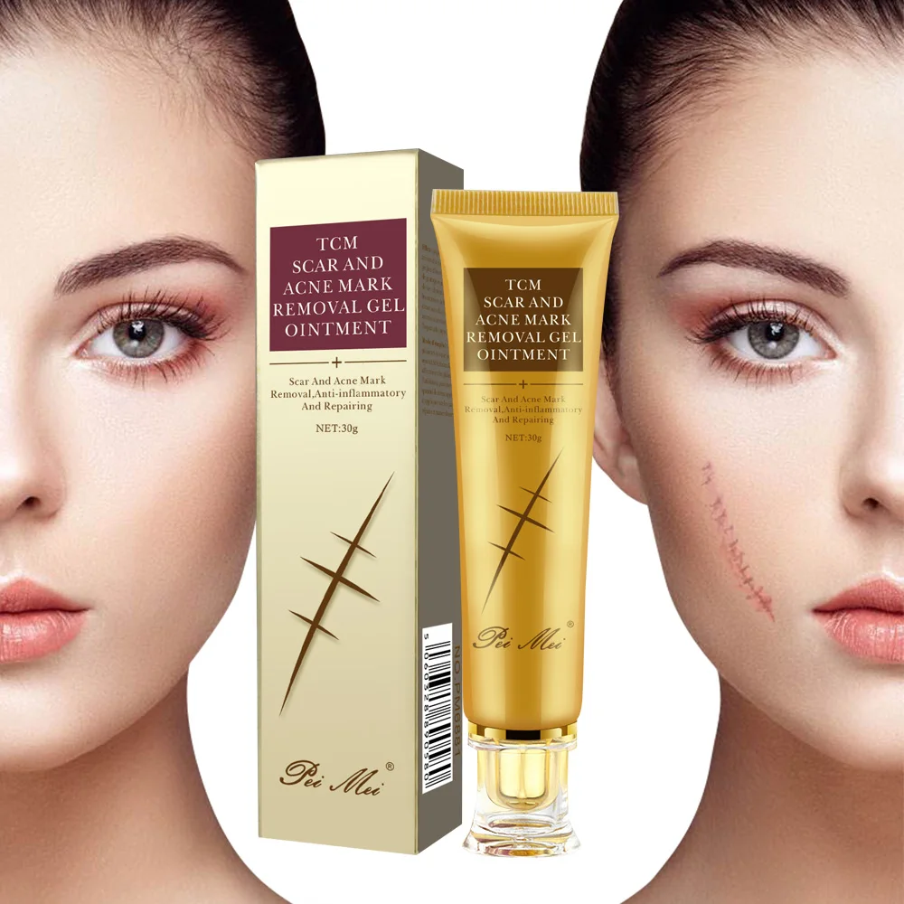 30g Acne Scar Removal Repair Cream Pimples Stretch Marks Face Gel Remove Smoothing Whitening Moisturizing Body Skin Care | Красота и