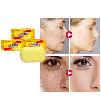 

Disinfection and Sterilization Sulfur Soap for Degreasing Psoriasis Seborrheic Eczema and Face Washing Soap for Men and Women