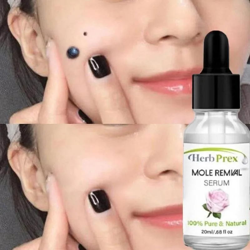 organic skin tag solution serum