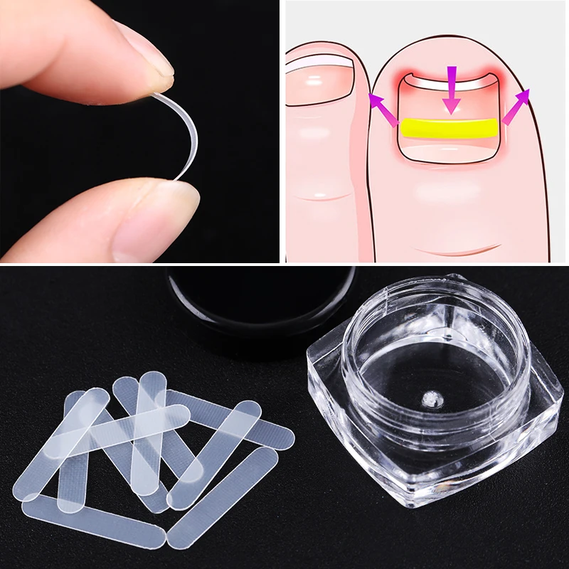 

10pcs/Box Ingrown Toes Finger Nails Correction Sticker Patch Clear Correction File Nail Care Treatment Tools for Nail Design