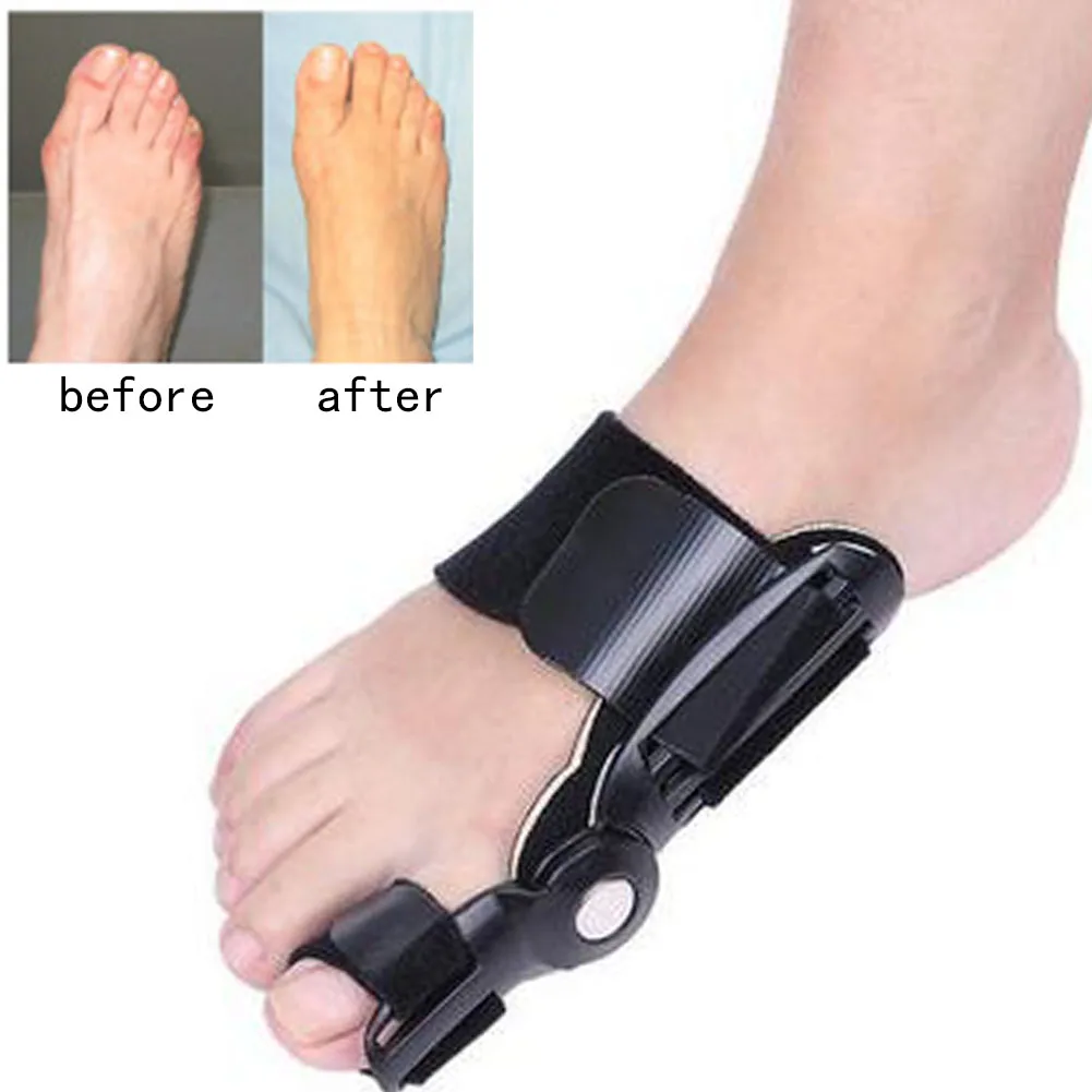Pain Relief Foot Care Corrector Belt Correction Tool Bunion Splint Straightener Hallux Valgus Big Toe Foot Corrector Adjustable