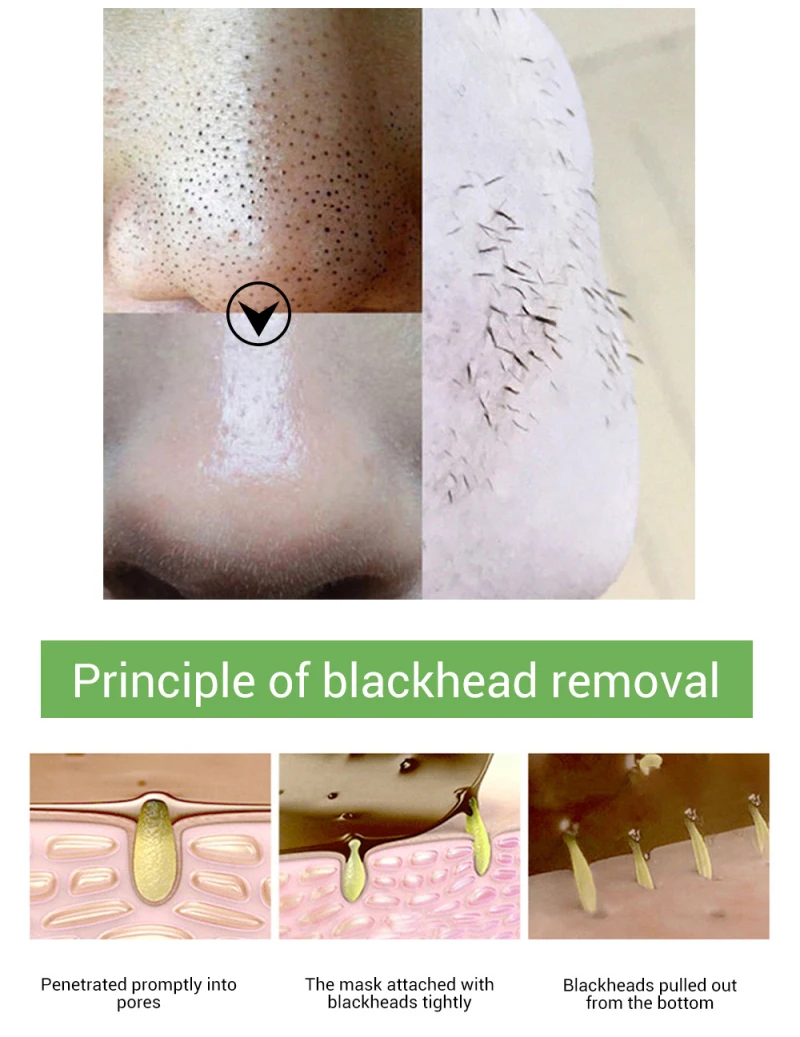 1 Набор, маска для ухода за кожей черных точек, очиститель пилинг, маска для лица, субстанция от угревой сыпи, лечение, сыворотка, сужает поры, эссенция TSLM2