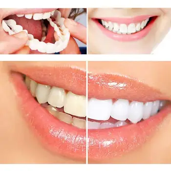 

1 Set Perfect Smile Teeth Veneers Top and Bottom Fake Whitening Cover Veneers Cosmetic Instant Denture Teeth Fit Comfort N4E5