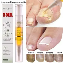 5 мл питательная ручка для ногтей удаляет грибок ногтей жидкий Уход за ногтями