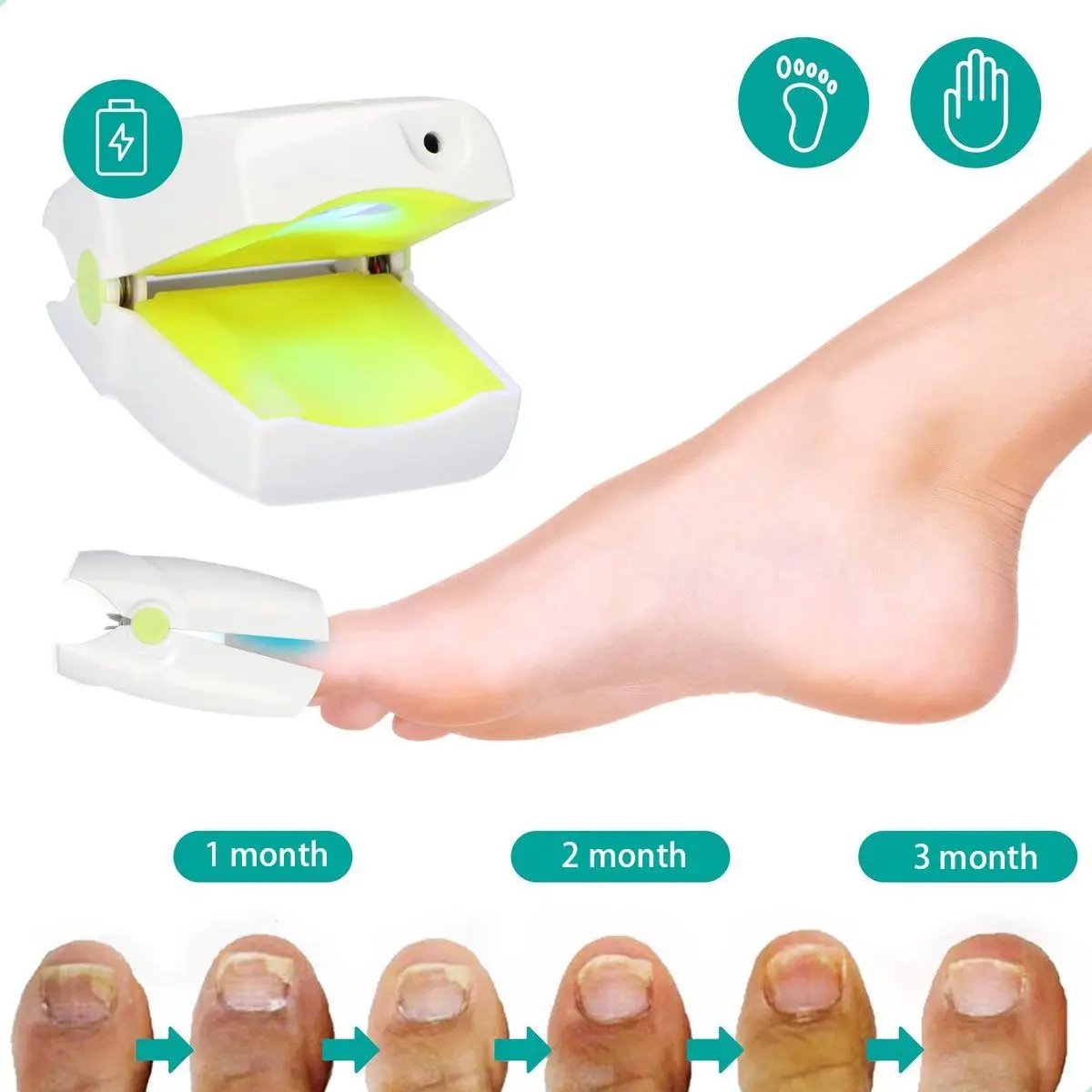 Toenail Fungus Treatment - Markham - Chiropodist - Mt Joy Foot Clinic