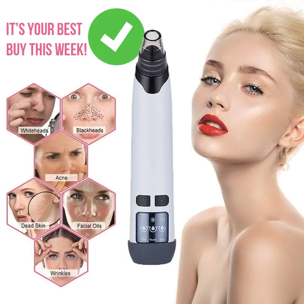 blackhead remover3
