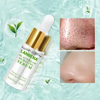 

15ml LANBENA Nose Deep Blackhead Softener Remover Export Derived Liquid Acne Repairment Skin Care