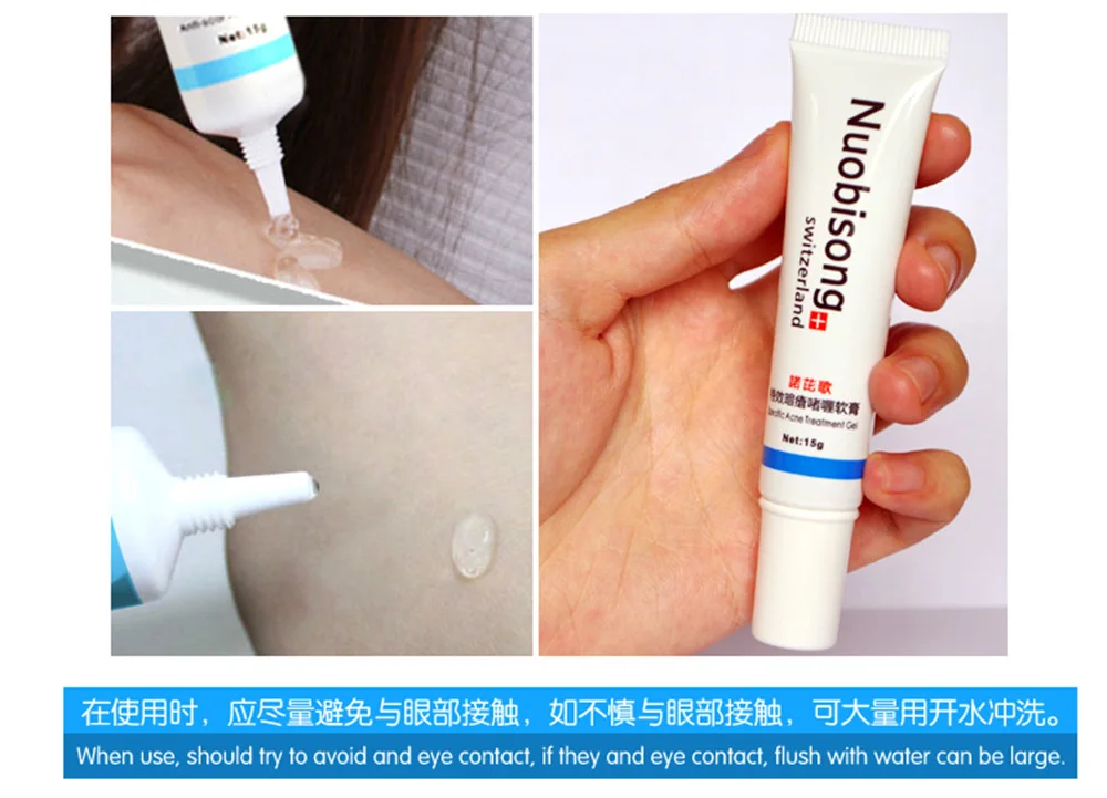 Nuobisong/Уход за кожей лица Прыщи шрамов удаление растяжек лечение от прыщей, отбеливание увлажняющий крем