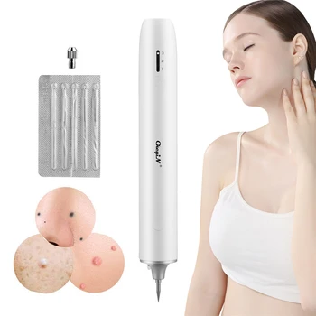 

Electric Mole Removal Pen Safe Home Blue Light Dark Spot Remover 3 Gear Skin Tag Warts Cleaner USB Rechargeable Beauty Device 31