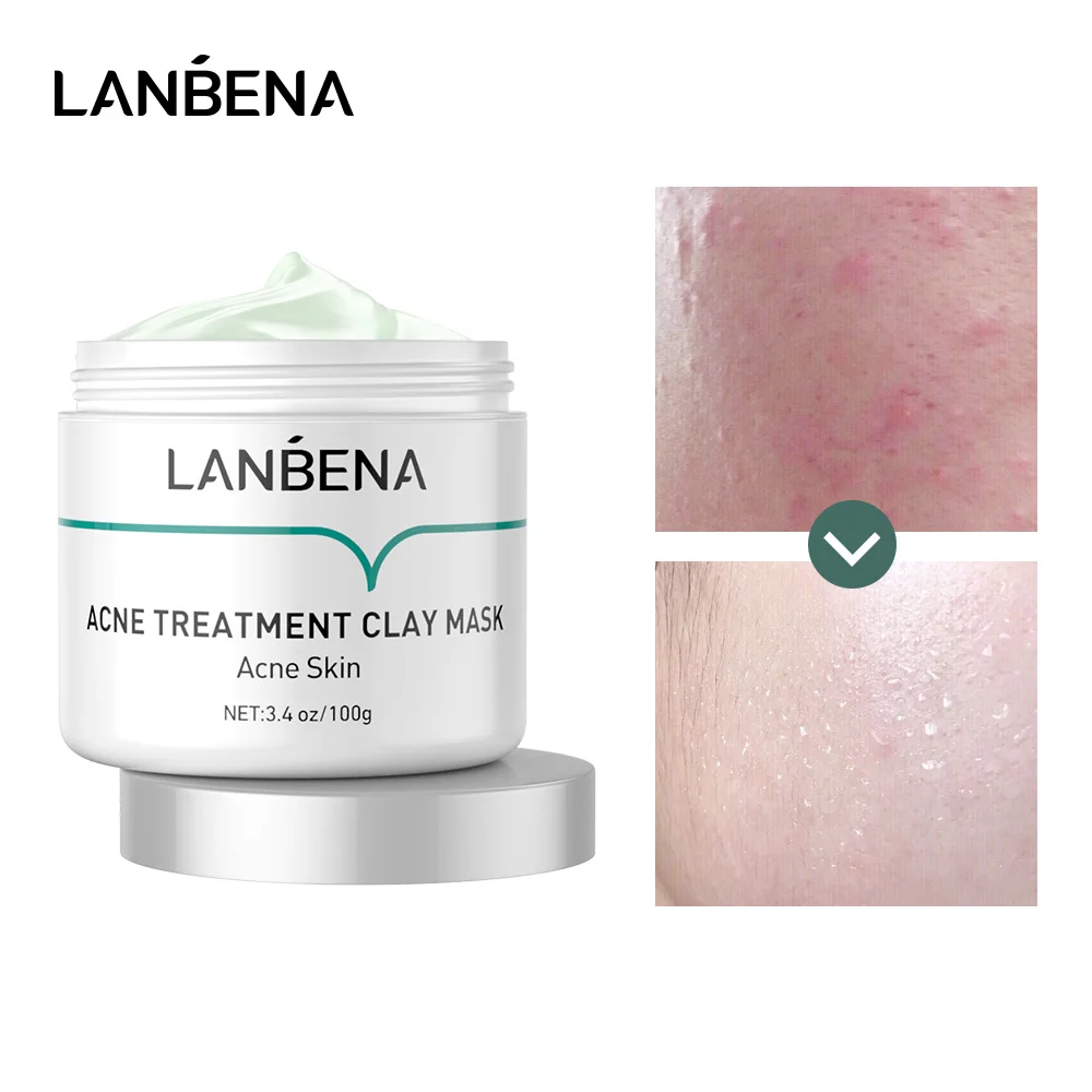 LANBENA Washable Acne Treatment Clay Mask Oil Control Deep Cleansing