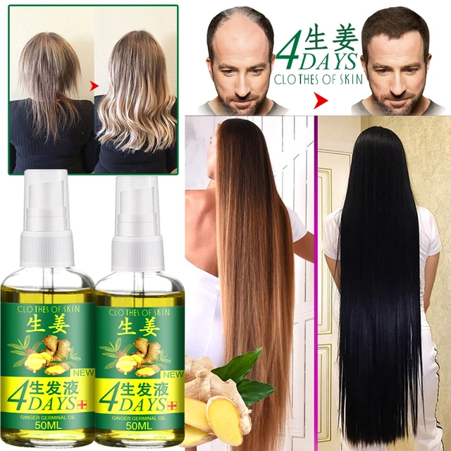Rapid Hair Growth Essence Hair Loss Treatment Fluid Hair Growth Natural Ginger Essence Spray 50/30/20/10ml 1