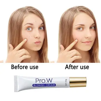 

Pro.W 30g Anti Acne Cream Oil Control Shrink Pores Cream Blemish Cream Spots Removal Treatment Pimple Ointment Scar Mark TSLM1
